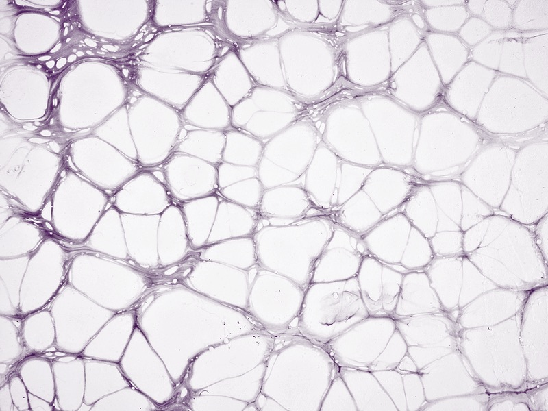 2023 study finds 40% of ATMPs are contaminated