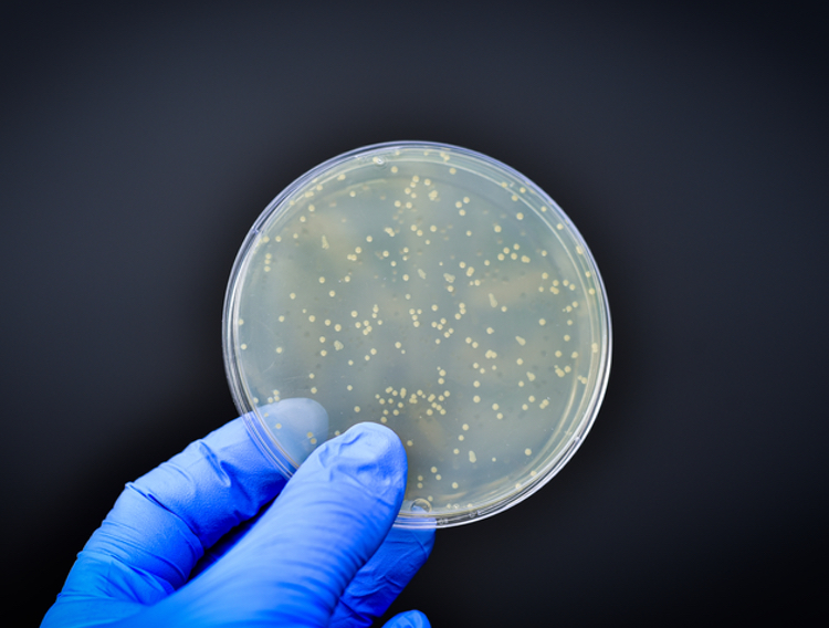 A look at fungal contamination testing of cleanroom insulation
