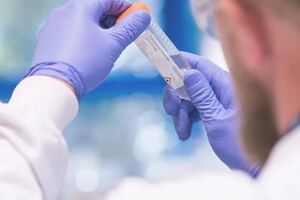 Abcam acquires Calico Biolabs