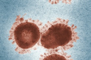 Acromec Engineers wins $14m high containment biosafety level research lab build