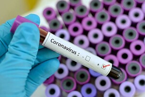 Advanced Sterilization Products on preventing the spread of coronavirus from contaminated medical devices