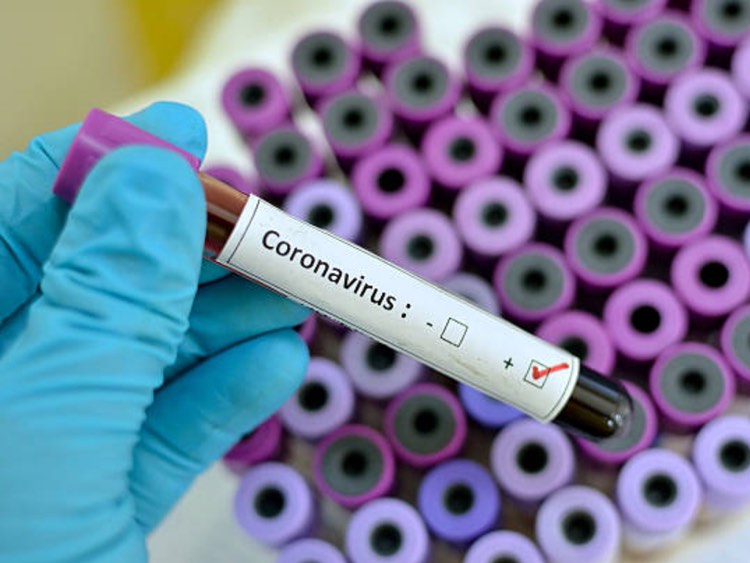 Advanced Sterilization Products on preventing the spread of coronavirus from contaminated medical devices