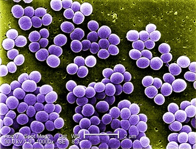 Fig. 1: <i>Staphylococcus aureus</i> – non-visible contamination. Source: www.pixnio.com