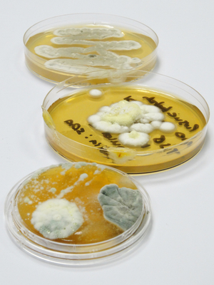 Validated databases of ITS sequences are being developed and in future ITS may become more commonly used for yeast and mould identification