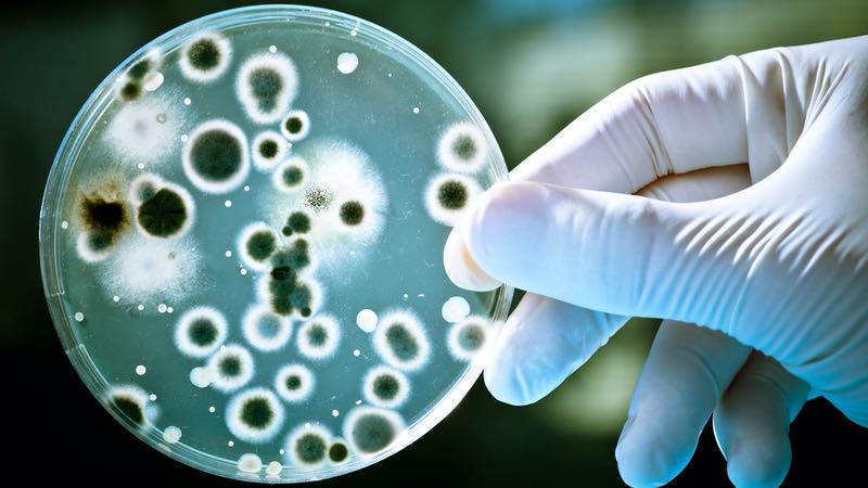 IDEXX receives UK Acceptance for Legionella pneumophila testing 