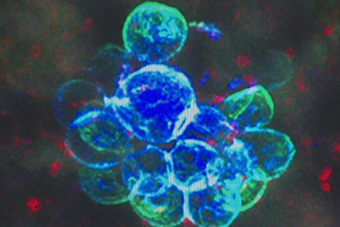 Australian discovery may help counter Legionnaires' disease outbreaks

