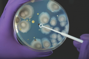 Bioburden – why the fuss?