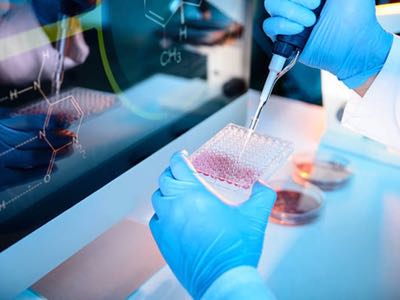 bioMerieux acquires molecular testing company