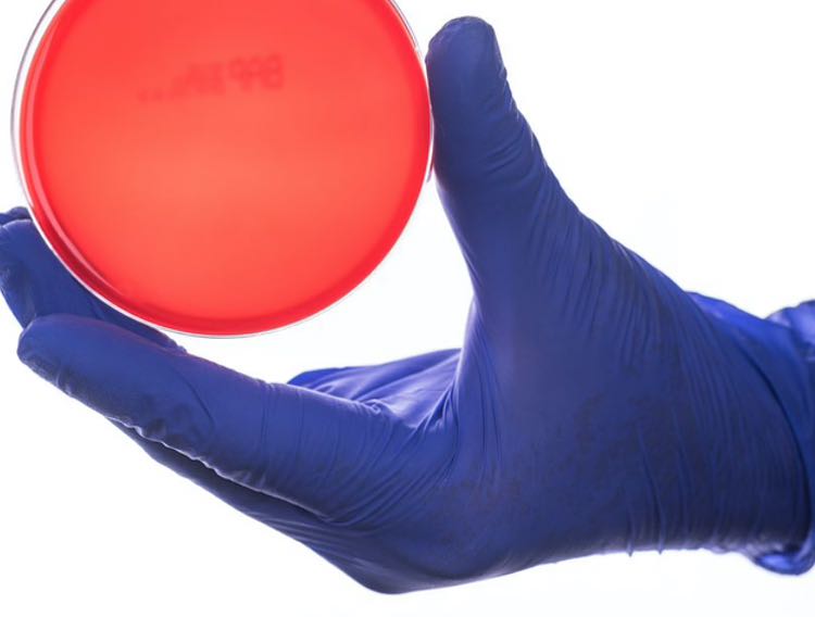 CE Technology plans $12m glove production expansion