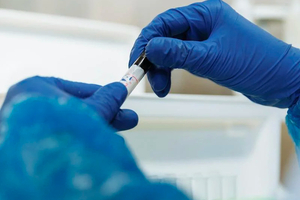 Charles River introduces the first rapid animal-free bacterial endotoxin test