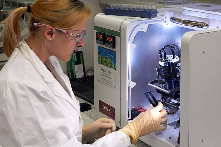 Chip detects Legionella in minutes