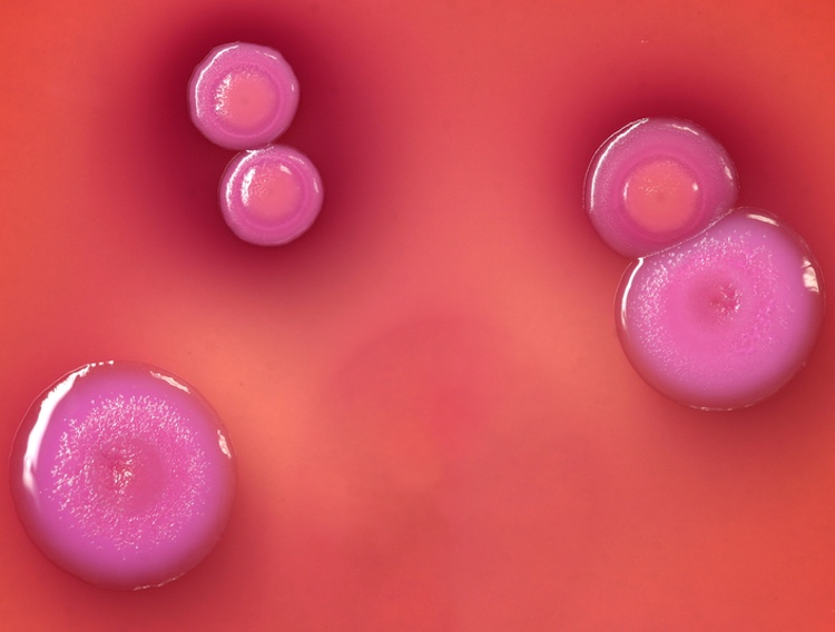 Common problems with the plate count method in cleanroom compliance
