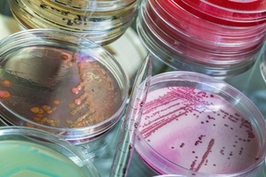 Environmental Monitoring: Strategies and limitations