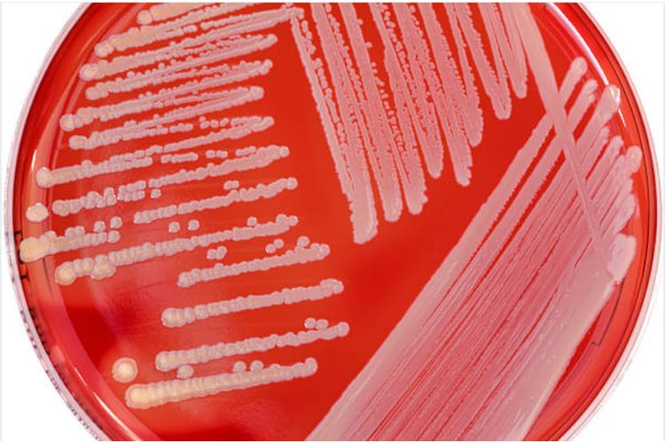 Hospital superbugs increasingly resistant to disinfectants