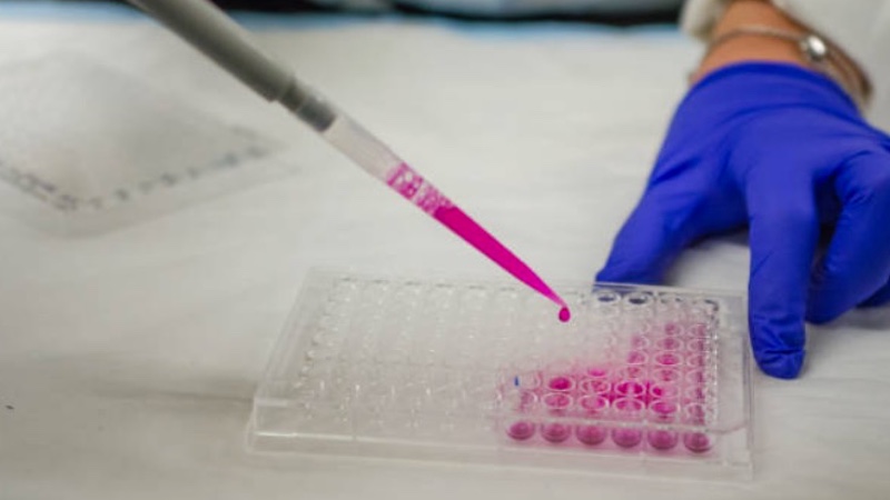Hygiena acquires Diagnostics Food Safety division of Biomedical
