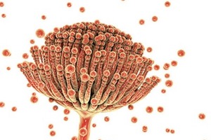 Hygiena acquires mycotoxin specialist