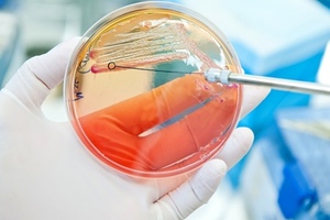 Key webinar for pharmaceutical QA microbiologists working in environmental monitoring