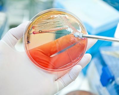 Key webinar for pharmaceutical QA microbiologists working in environmental monitoring