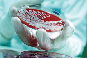 Maintaining control of bioburden