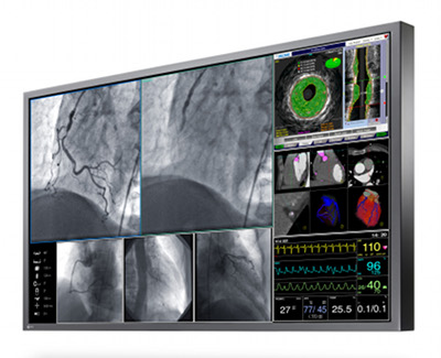 Medical colour monitor is suitable for a range of applications