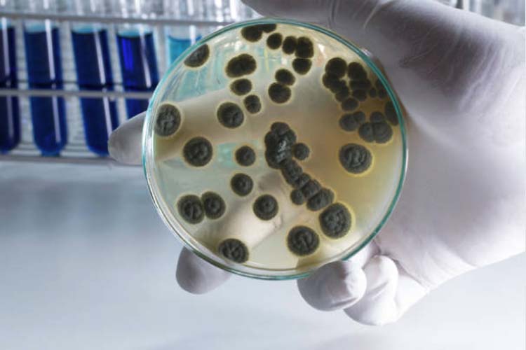 Microbial test unveils fungus problem at NASA lab