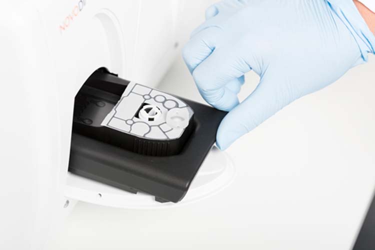 Mobidiag inks agreement with Ginolis 