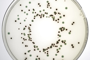 New addition to Lab M’s Pinnacle pre-poured plates improves accuracy of Salmonella confirmation