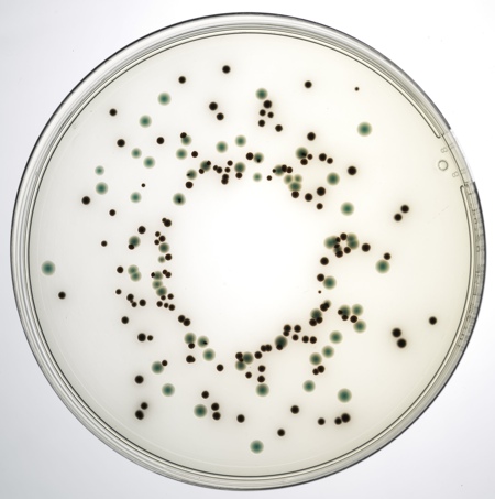 New addition to Lab M’s Pinnacle pre-poured plates improves accuracy of Salmonella confirmation