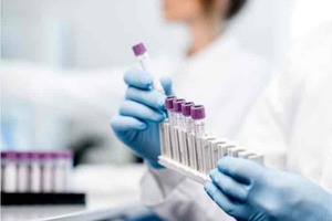 Novacyt completes sale of Clinical Lab