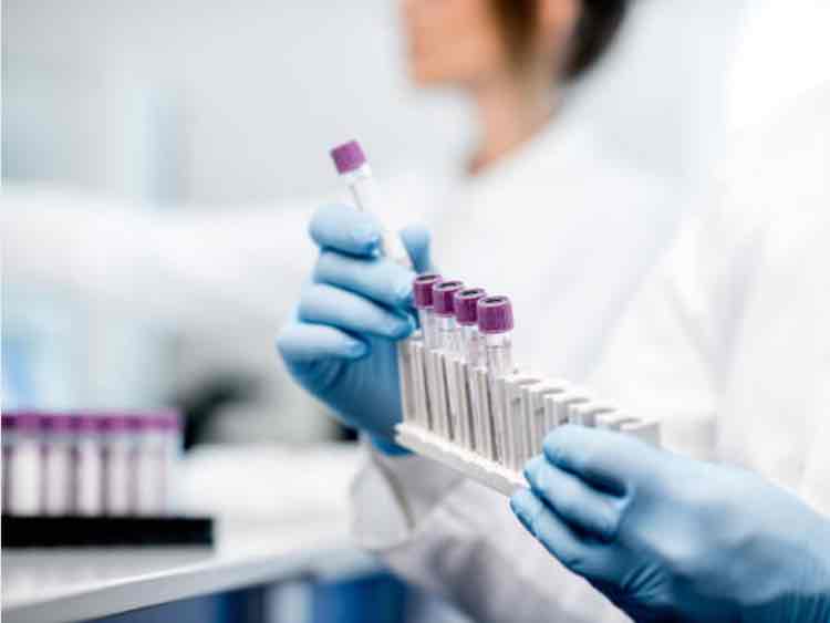 Novacyt completes sale of Clinical Lab