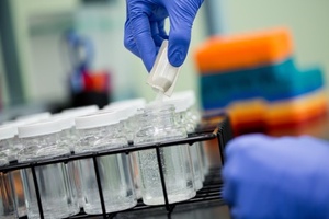 Pseudalert gets UK acceptance for Pseudomonas testing in drinking water