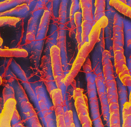 Reducing the <i>C. diff</i> burden at Gloucestershire Hospitals 