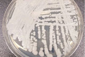 Rise in number of Candida auris cases prompts PHE to issue new guidance
