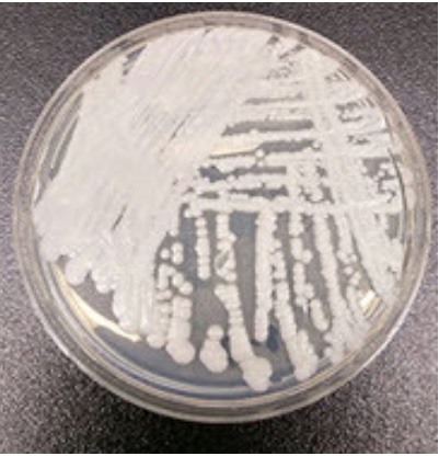 Rutgers University researchers to investigate emerging fungal infection Candida auris
