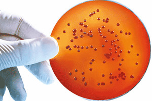 SGL introduces a pre-poured Burkholderia cepacia Agar 90mm plate
