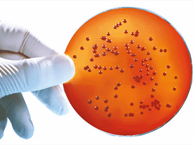 SGL introduces a pre-poured Burkholderia cepacia Agar 90mm plate
