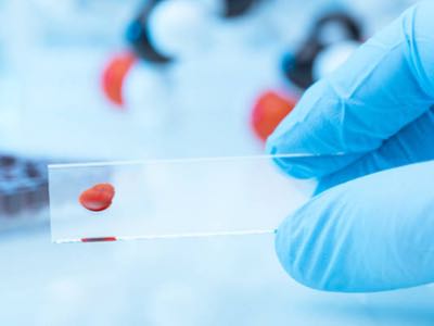 Sphere Fluidics closes $2 million investment round