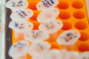 Study finds $1 per reaction LAMP assay works for BCC testing