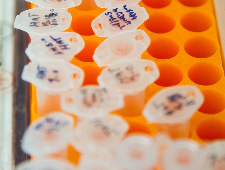 Study finds $1 per reaction LAMP assay works for BCC testing