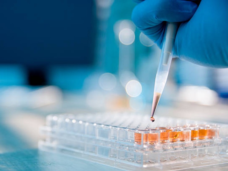 Swiss NBE-Therapeutics chooses WuXi Biologics as manufacturing partner