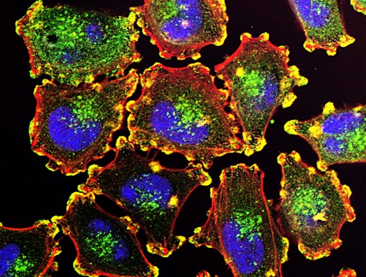TCR2 chooses bigger expansion for cancer therapy manufacturing