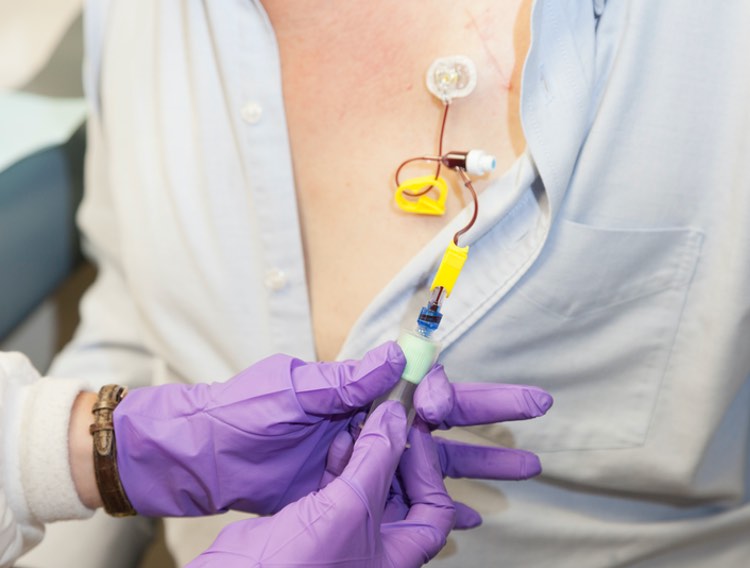 The regulations don't go far enough: Glove permeation testing in chemotherapeutics