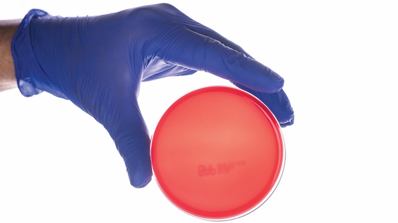 Validation of contact plates for environmental monitoring